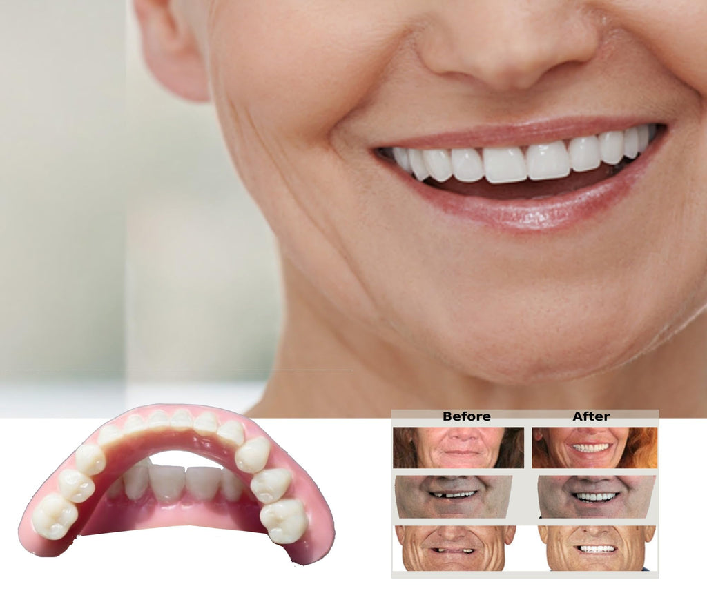 DIY Dentures Kit A791161