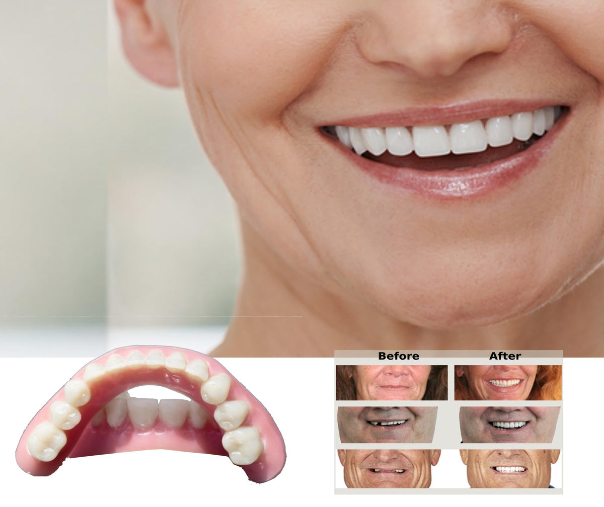 DIY Dentures Kit A791161